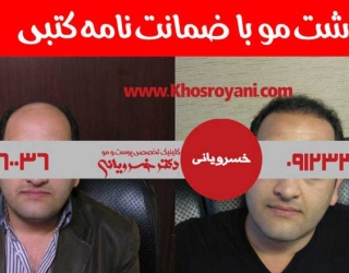 کلینیک کاشت مو دکتر خسرویانی در تهران
