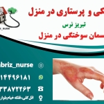 سوختگی_1706074782226