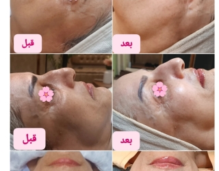 مراقبت زیبایی ماه چهره 