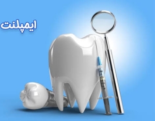 کلینیک ایمپلنت