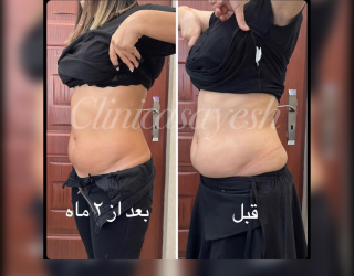 photo-output