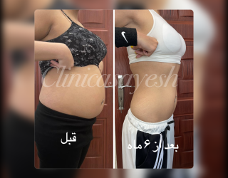 photo-output