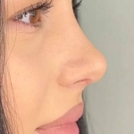 1000020605