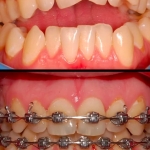 1000190594