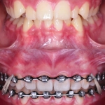 1000190595