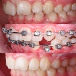 1000088027