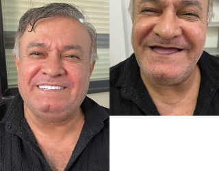 دندانسازی محلات ( فتح المبین )