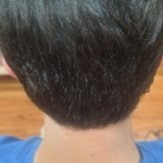 1000628458