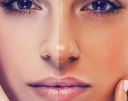 برنزه-در-تهران