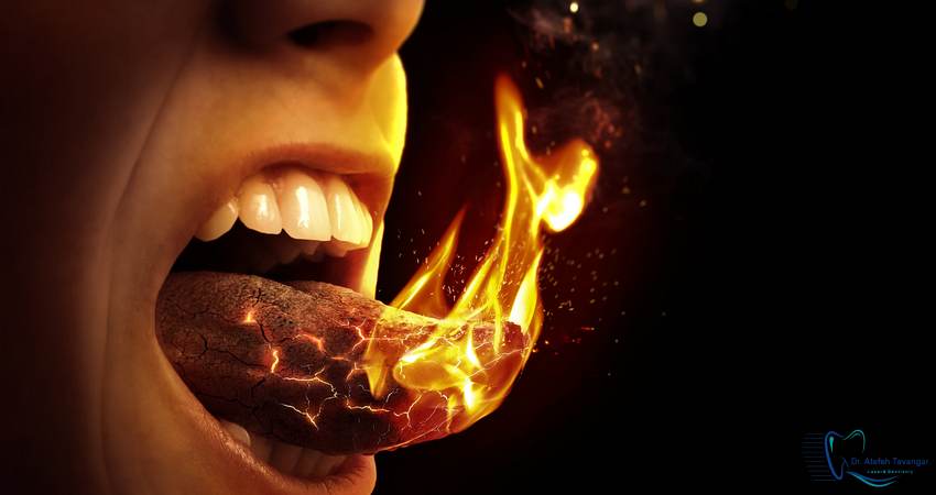 برای سوزش زبان به چه دکتری مراجعه کنیم؟ دکتر عاطفه توانگر