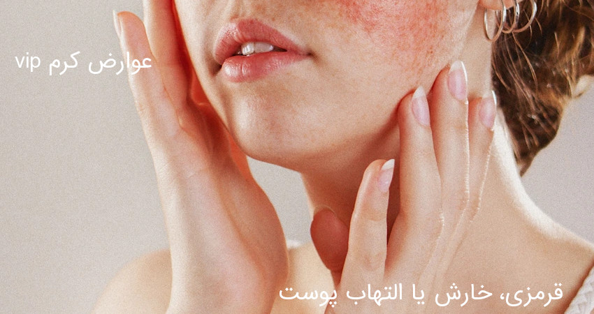 عوارض کرم vip