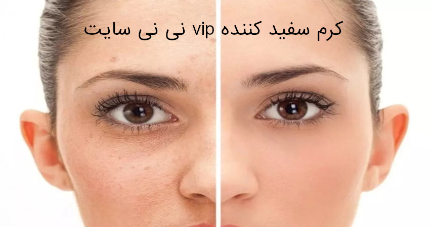 کرم سفید کننده vip نی نی سایت